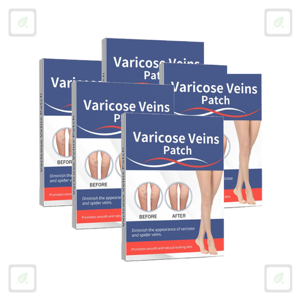 Varicose
